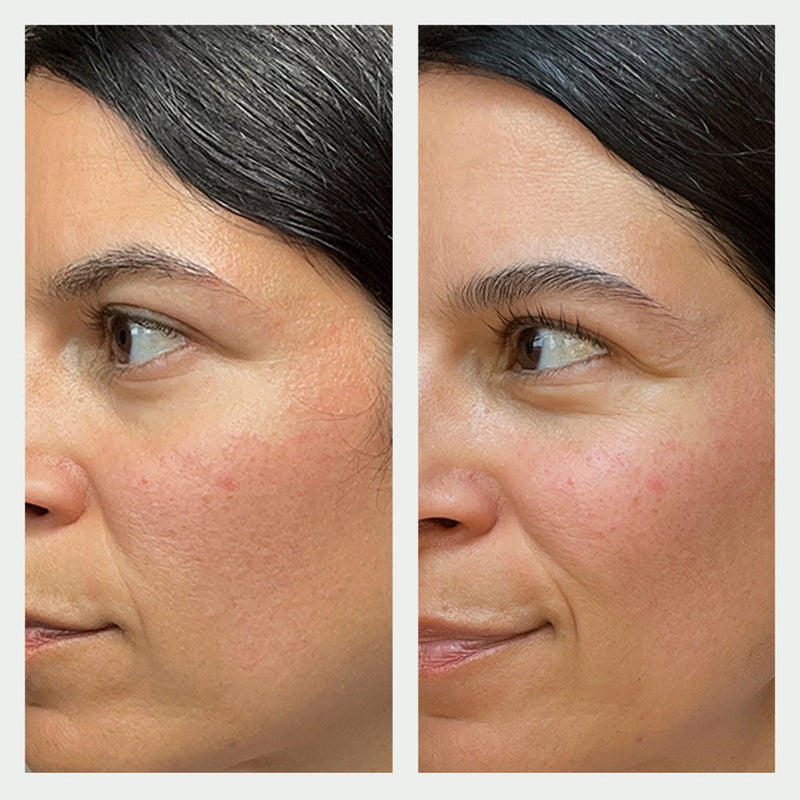 Maximalist Regenerating Cleanser Before and After