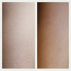 Resurfacing Body Serum Before and After 2