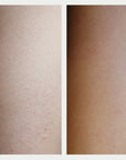 Resurfacing Body Serum Before and After 2