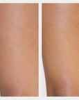 Resurfacing Body Serum Before and After