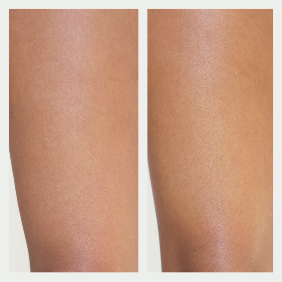 Resurfacing Body Serum Before and After
