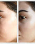 Resurfacing Mask Before and After 2