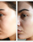 Resurfacing Serum Before and After