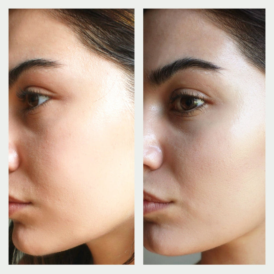 Resurfacing Serum Before and After